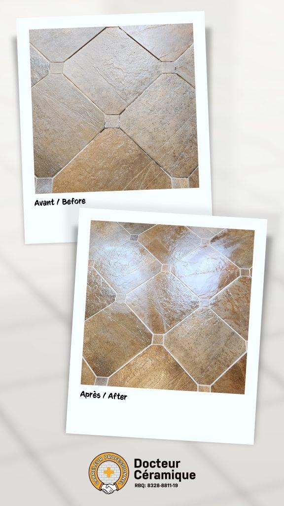 before and after ceramic doctor (3)