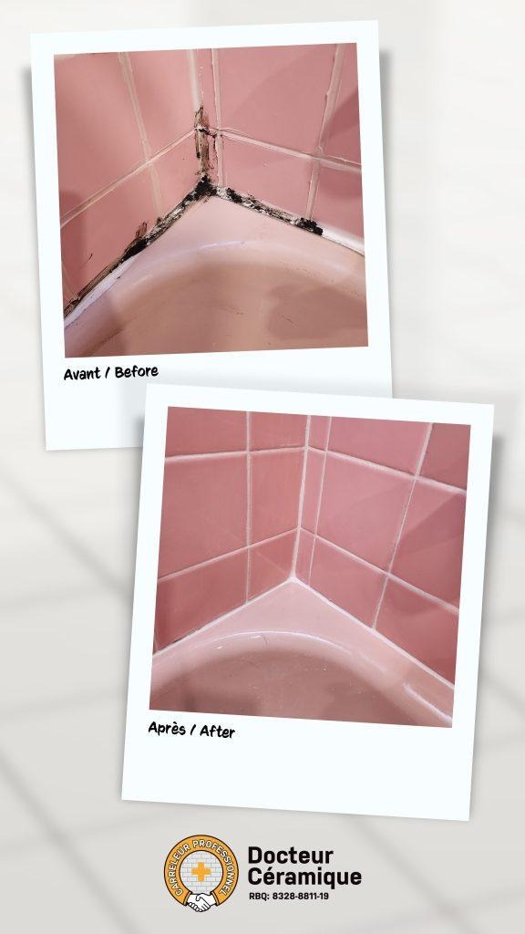 before and after ceramic doctor (31)