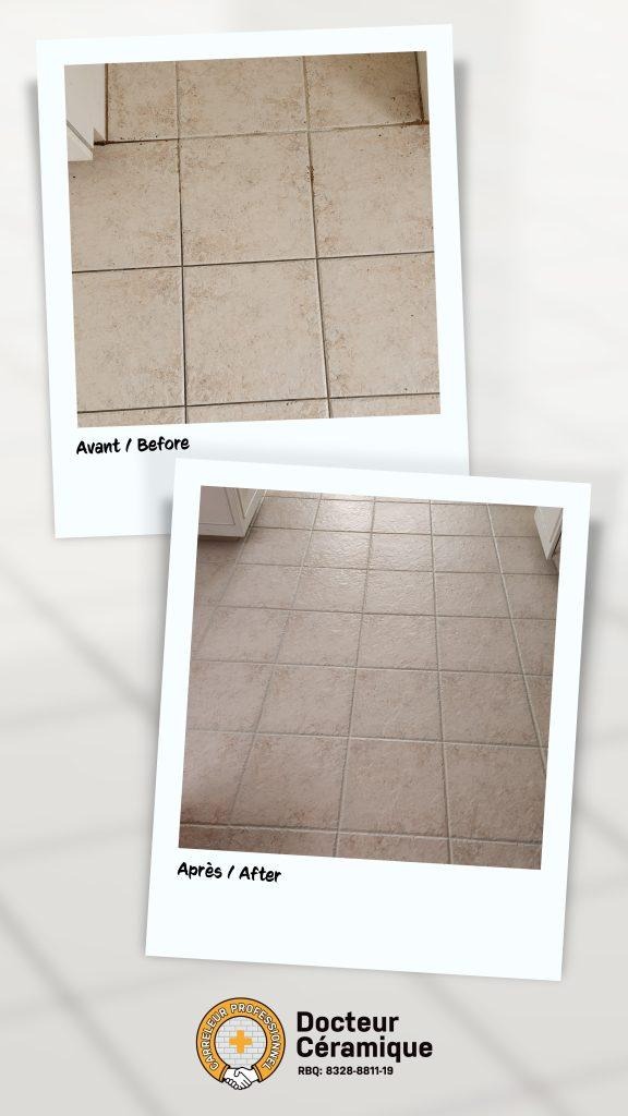 before and after ceramic doctor (45)