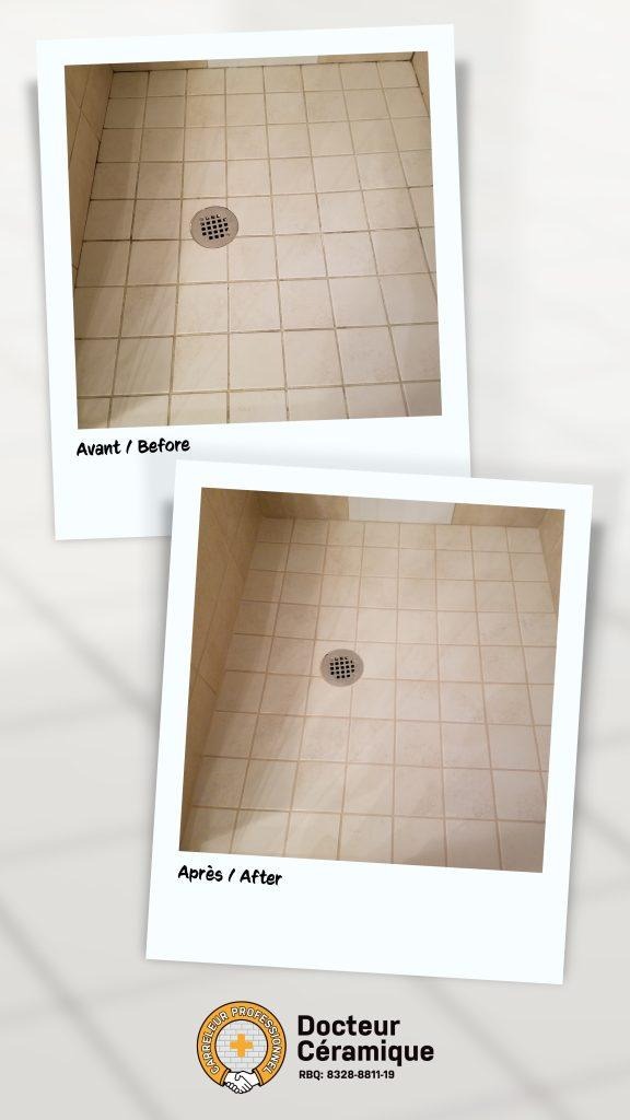 before and after ceramic doctor (47)