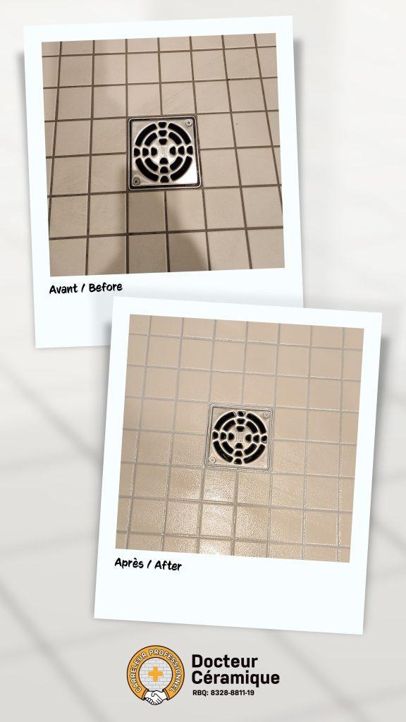 before and after ceramic doctor (48)