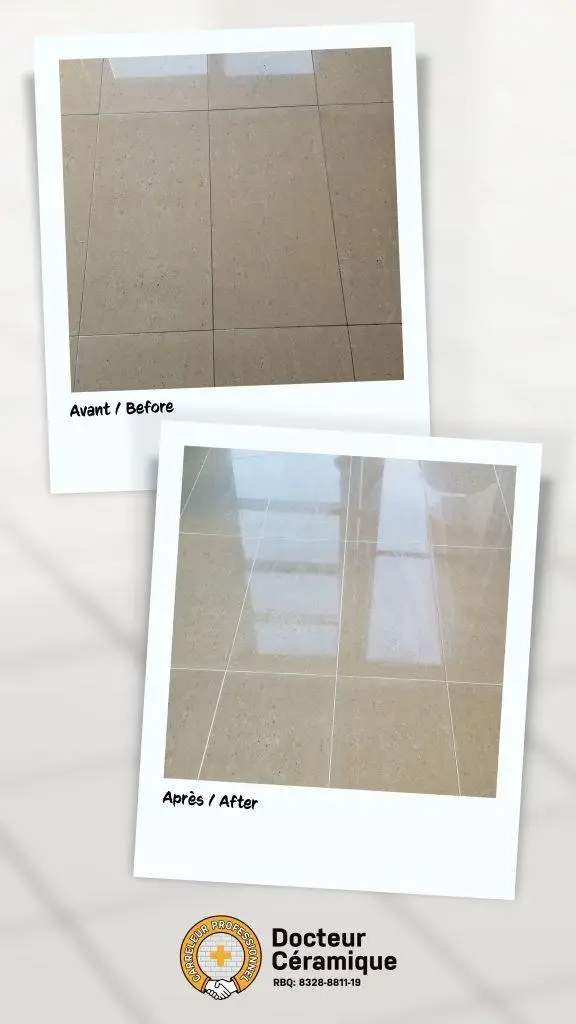 before and after ceramic doctor (5)