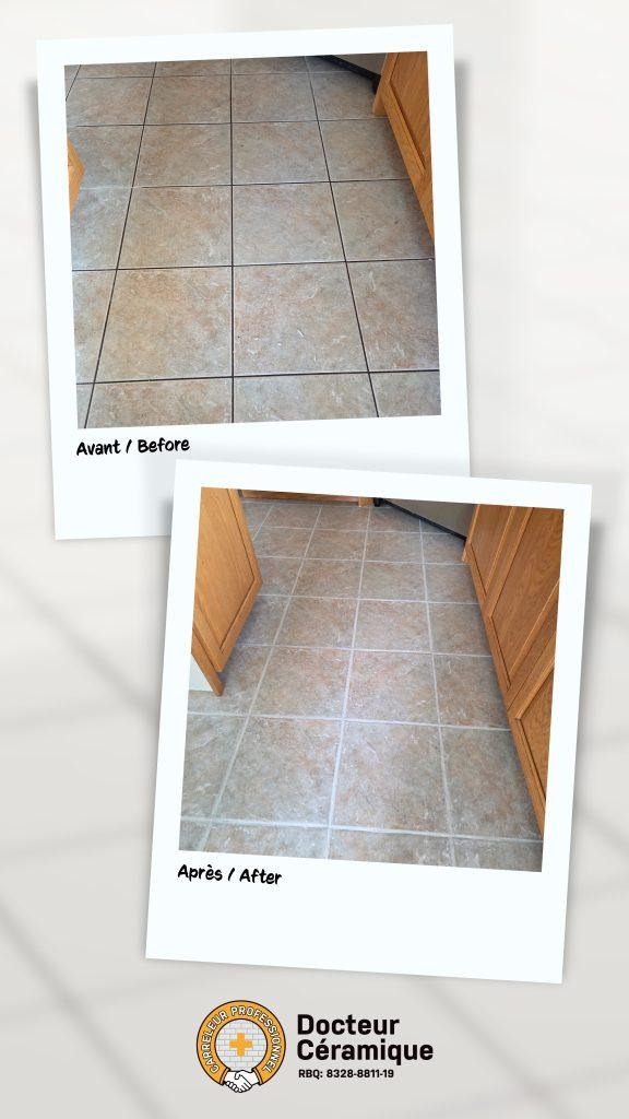 before and after ceramic doctor (53)