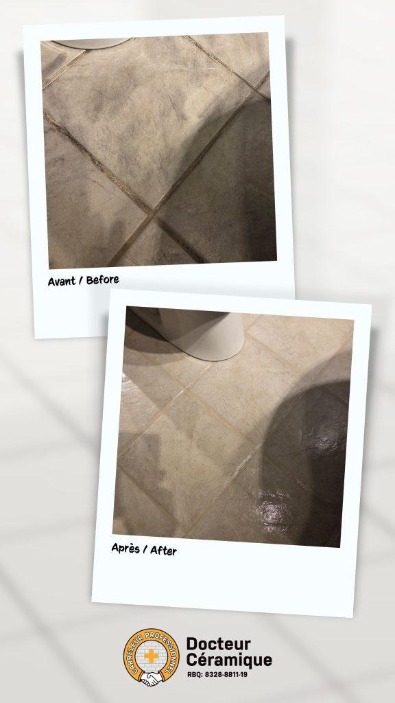 before and after ceramic doctor (54)
