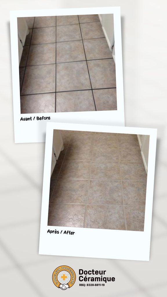 before and after ceramic doctor (56)