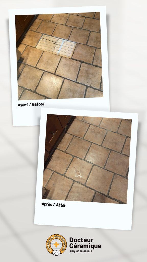 before and after ceramic doctor (65)