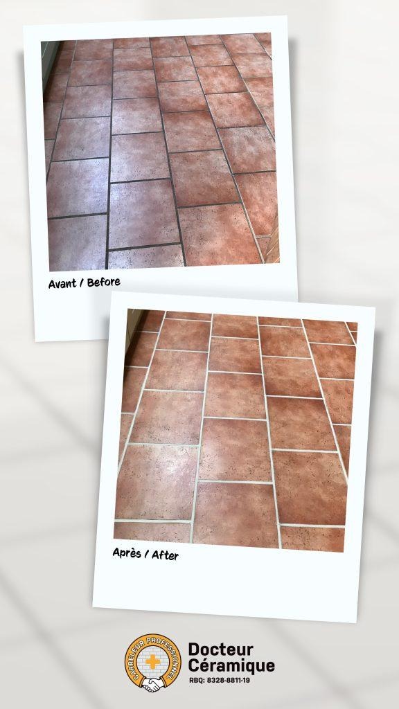 before and after ceramic doctor (71)