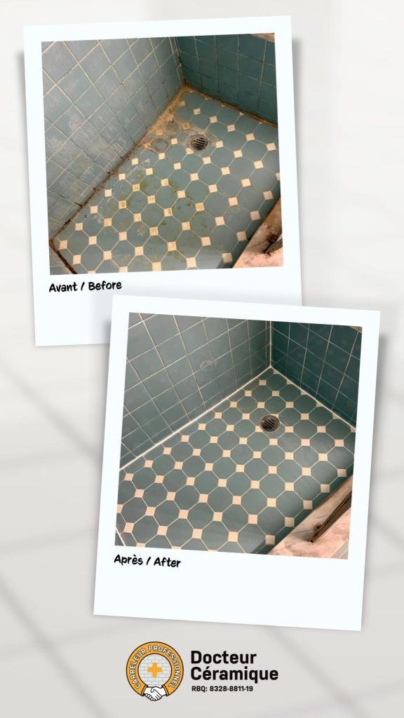 before and after ceramic doctor (76)