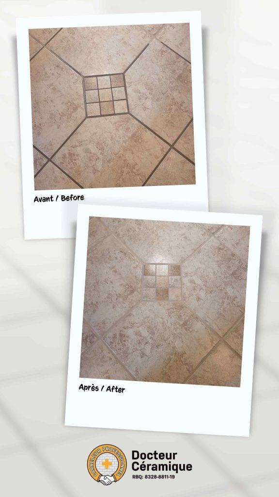 before and after ceramic doctor (85)